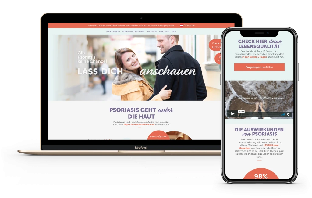 Website ueber Psoriasis auf Laptop und Smartphone. Die Seite enthaelt eine Kampagne mit dem Slogan Gib Psoriasis keine Chance! Lass dich anschauen, sowie Informationen ueber die Erkrankung, ihre Auswirkungen und Behandlungsmoeglichkeiten.