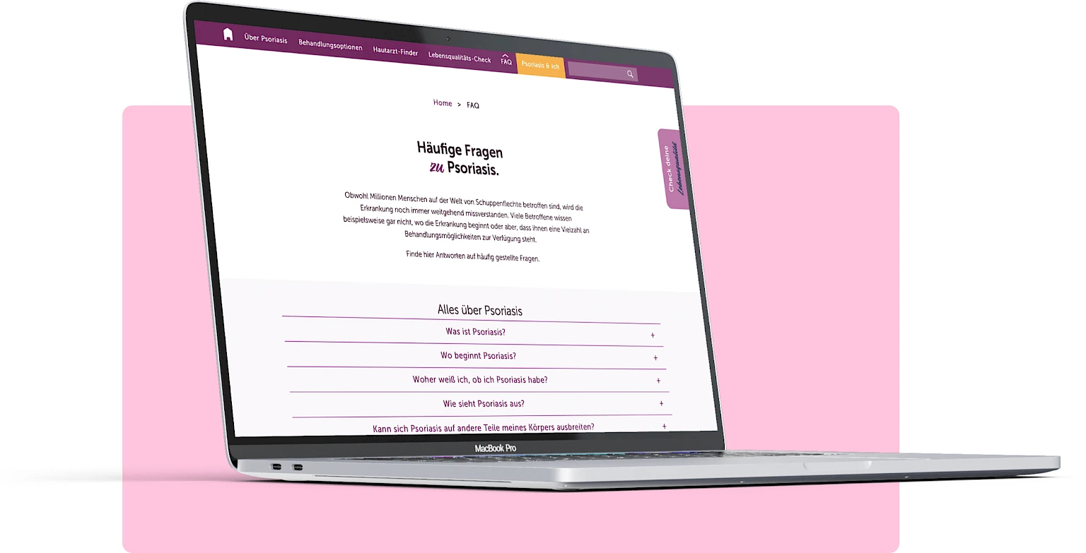 MacBook Pro mit geoeffneter FAQ-Seite einer Psoriasis-Website: benutzerfreundliche Navigation mit Suchfunktion und Lebensqualitaets-Check